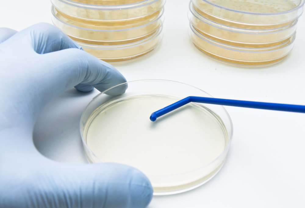Petri dishes sold under a private label require the technical parameters, packaging method, and intended use to be defined before production begins. If the product is to be used in in vitro diagnostics, additional requirements arising from IVD regulations also apply. That is why it is worth checking how the entire process works and which decisions need to be made at each stage.