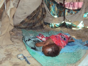 A four-year-old girl with meningitis sleeps in a makeshift tent in Sigale camp. Her parents left her to go beg for aid.  - Shafii Mohyaddin Abokar/IPS
