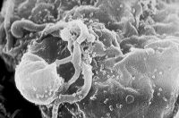 HIV in human cell. / Credit:Public domain